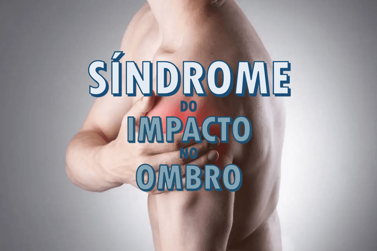 Tratamento Fisioterapêutico para a Síndrome do Impacto no Ombro